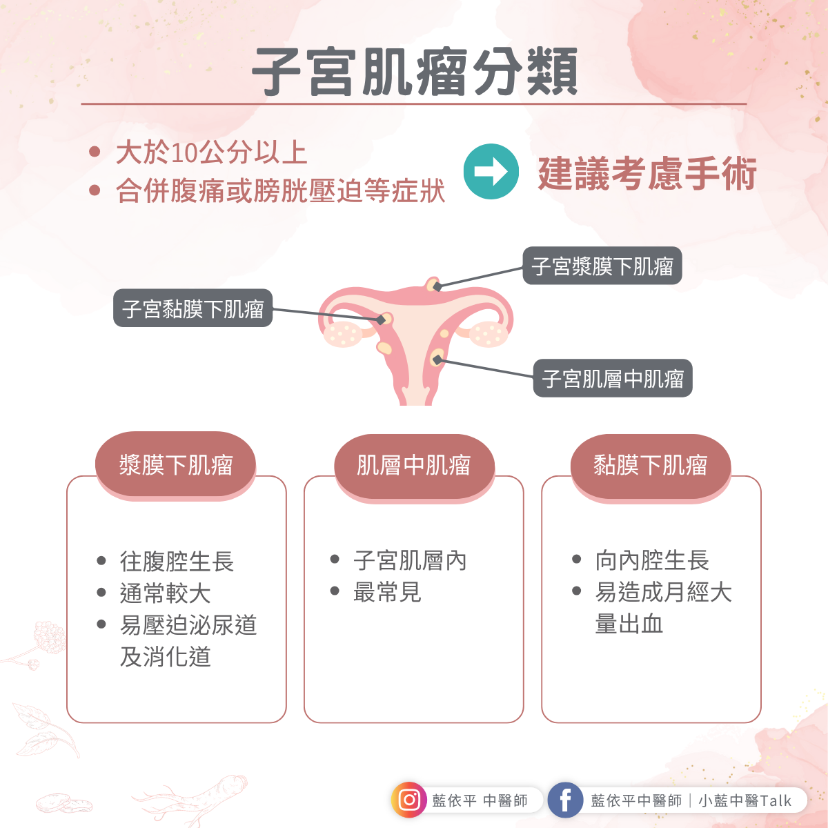 子宮肌瘤一定要開刀嗎? 子宮肌瘤 分類