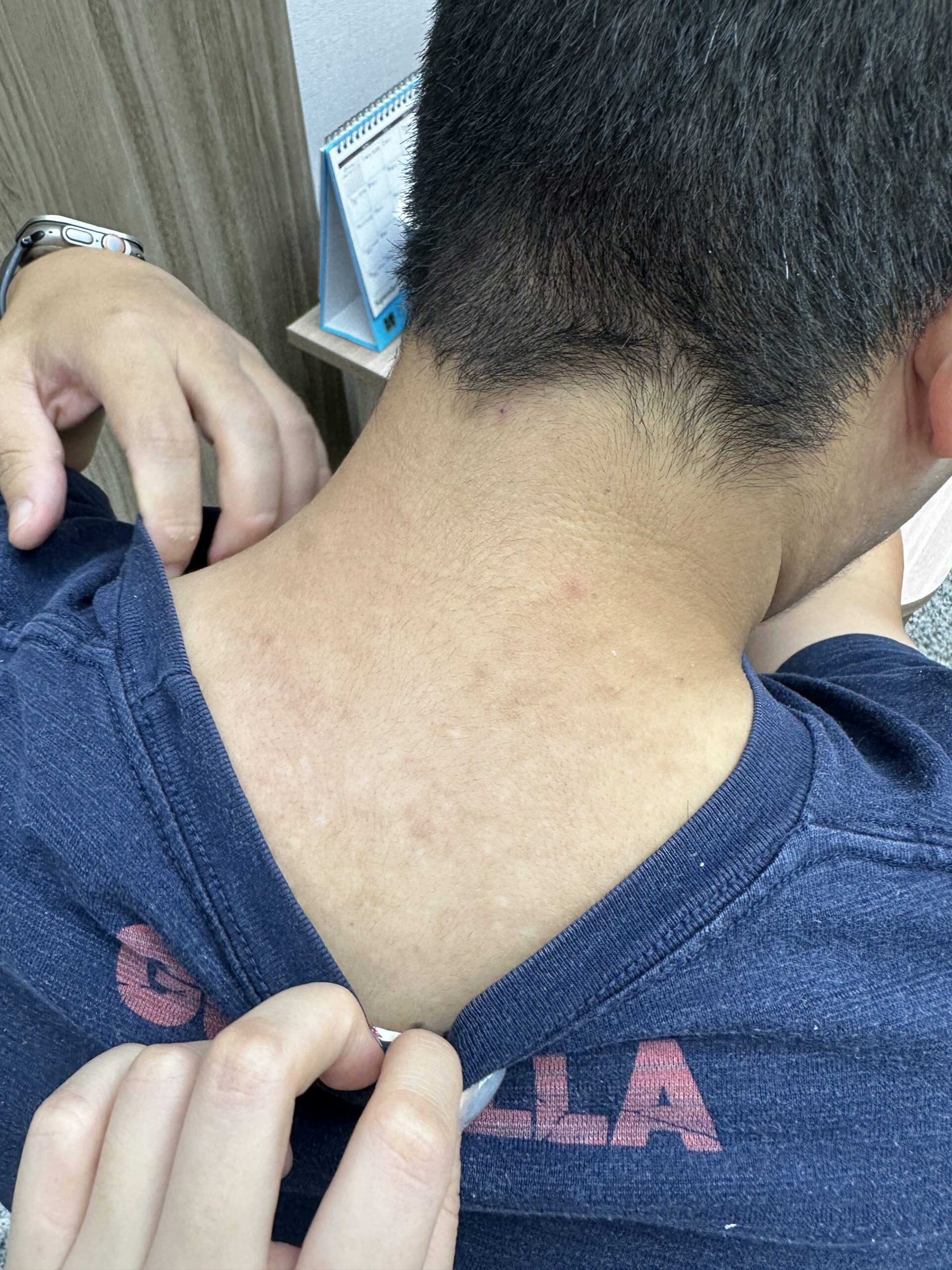 38歲奶爸的皮膚炎：其實是體內濕熱在作怪 藍依平中醫師｜依心為你-小藍中醫師