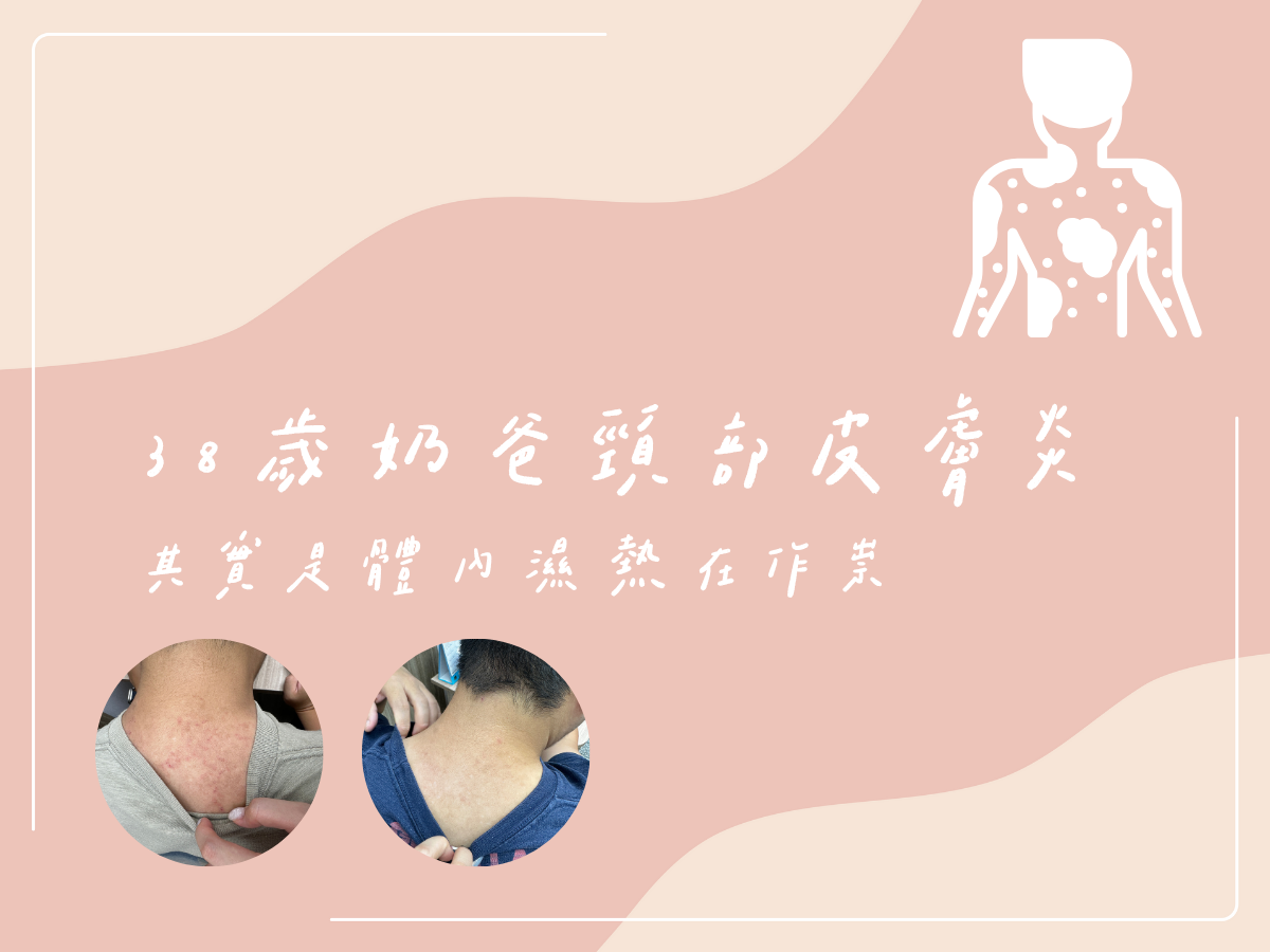 38歲奶爸的皮膚炎：其實是體內濕熱在作怪 藍依平中醫師｜依心為你-小藍中醫師
