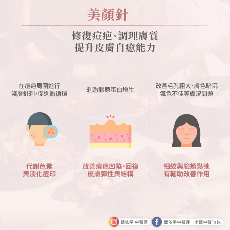 美顏針 痘痘