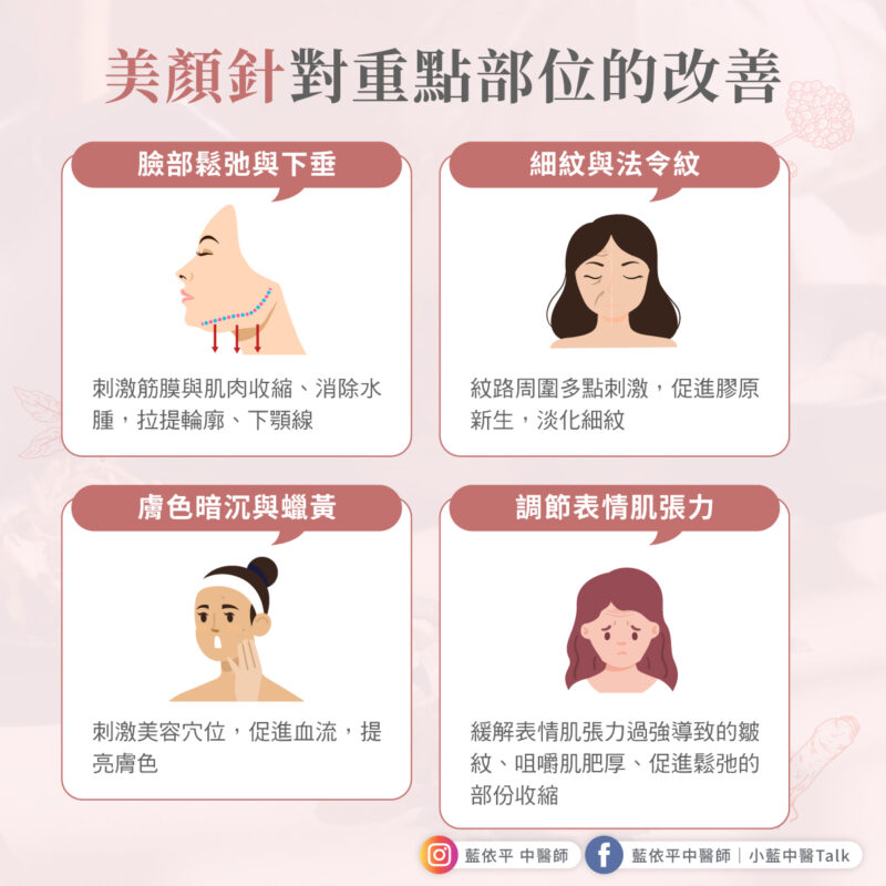 美顏針是什麼?一次了解中醫自然拉提與膠原蛋白修復的秘密 美顏針 部位