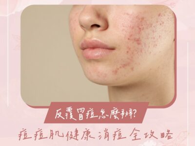 反覆冒痘
