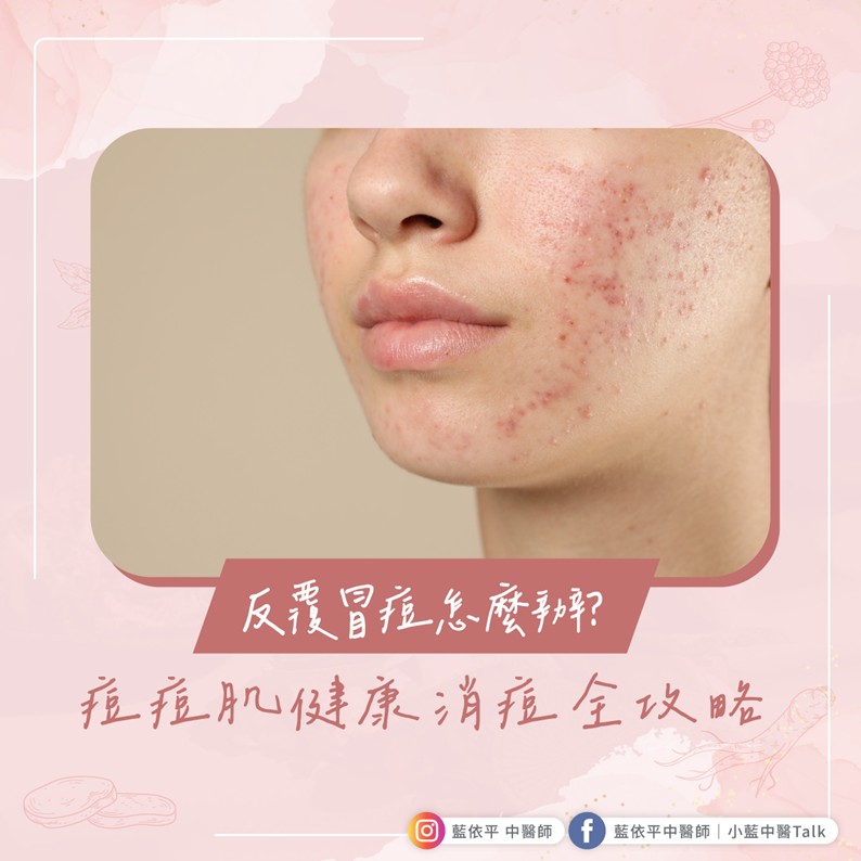 反覆冒痘