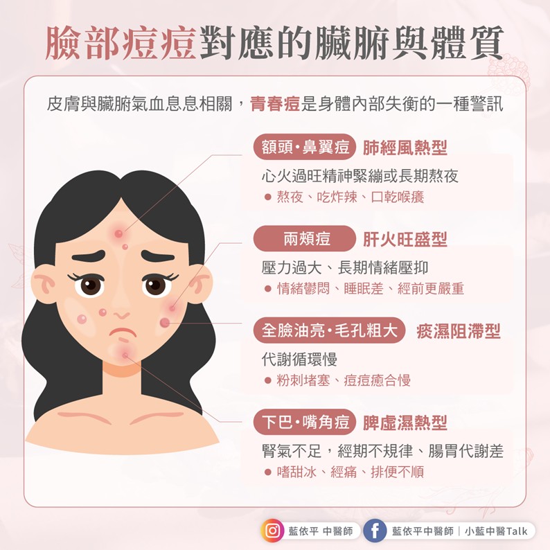 反覆冒痘怎麼辦?從中醫角度看青春痘成因與調理法 痘痘 體質